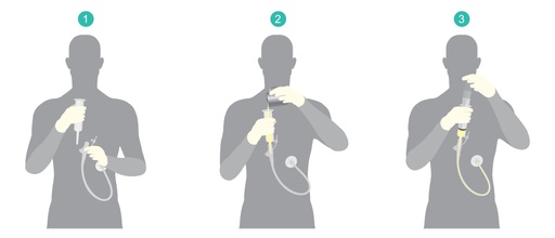 [Noordhoff] PEG-sonde verzorgen en verwisselen (TZ46)